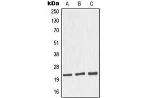 Western blot analysis of Nop30 expression in MCF7 (A), HeLa (B), mouse brain (C), rat brain (D) whole cell lysates. (NOL3 Antikörper  (C-Term))
