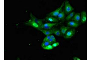 Immunofluorescent analysis of HepG2 cells using ABIN7156331 at dilution of 1:100 and Alexa Fluor 488-congugated AffiniPure Goat Anti-Rabbit IgG(H+L) (Insulin Receptor Antikörper  (AA 1023-1298))