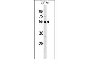 Western blot analysis in CEM cell line lysates (35ug/lane). (RBBP7 Antikörper  (AA 191-219))