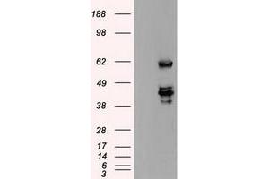 HEK293T cells were transfected with the pCMV6-ENTRY control (Left lane) or pCMV6-ENTRY SSB (Right lane) cDNA for 48 hrs and lysed. (SSB Antikörper)