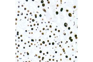 Immunohistochemistry of paraffin-embedded human liver using HNRNPM Rabbit mAb (ABIN7267635) at dilution of 1:100 (40x lens). (HNRNPM Antikörper)