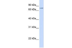 WB Suggested Anti-SYDE1  Antibody Titration: 0. (SYDE1 Antikörper  (C-Term))
