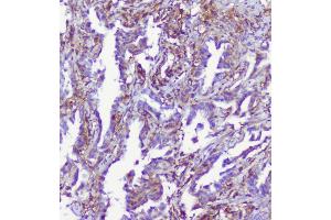 IHC analysis of RP2 using anti-RP2 antibody (ABIN6719513). (RP2 Antikörper  (AA 244-348))