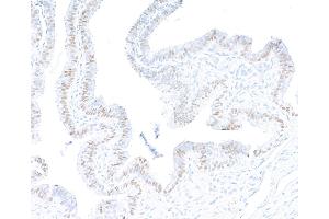 Immunohistochemistry (IHC) image for anti-Paired Box 8 (PAX8) (AA 225-275) antibody (ABIN7795777) (Rekombinanter PAX8 Antikörper  (AA 225-275))