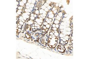Immunohistochemistry of paraffin embedded mouse colon using SEC238 (ABIN7075521) at dilution of 1:650 (400x lens) (Sec23 Homolog B Antikörper)