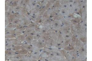 IHC-P analysis of Pig Cardiac Muscle Tissue, with DAB staining. (CKM Antikörper  (AA 11-367))
