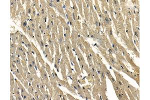ABIN7097126 and ABIN7101194 at 1/100 staining rat heart tissue by IHC-P.