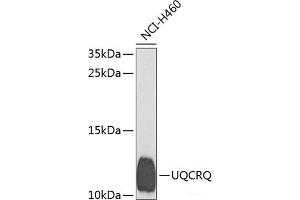 Western blot analysis of extracts of H460 cells using UQCRQ Polyclonal Antibody at dilution of 1:1000. (UQCRQ Antikörper)