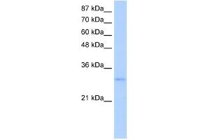 EXOSC6 antibody used at 5 ug/ml to detect target protein. (EXOSC6 Antikörper  (N-Term))