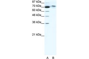 Western Blotting (WB) image for anti-Chromosome 14 Open Reading Frame 101 (C14orf101) antibody (ABIN2460921) (C14orf101 Antikörper)