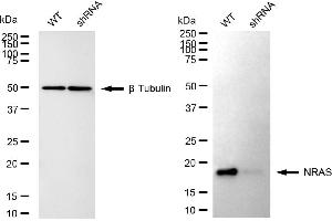 Western blotting analysis using NRAS antibody (ABIN7798817).