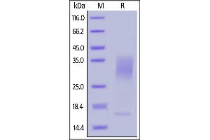 SDS-PAGE (SDS) image for Interleukin 13 (IL13) (AA 21-132) (Active) protein (His tag,AVI tag,Biotin) (ABIN6950979)
