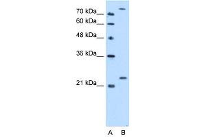 WB Suggested Anti-PCMT1 Antibody Titration:  2. (PCMT1 Antikörper  (Middle Region))