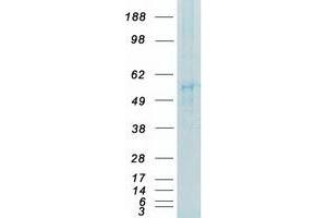 Western Blotting (WB) image for FYN Oncogene Related To SRC, FGR, YES (FYN) (Transcript Variant 2) protein (Myc-DYKDDDDK Tag) (ABIN2721481)
