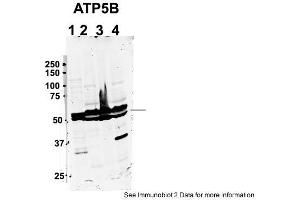 Sample Type: 1. (ATP5B Antikörper  (C-Term))