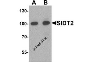 Western Blotting (WB) image for anti-SID1 Transmembrane Family, Member 2 (SIDT2) (N-Term) antibody (ABIN1077417) (SIDT2 Antikörper  (N-Term))