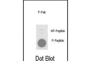 Dot blot analysis of anti-Phospho-PLB-T17 Phospho-specific Pab (ABIN650834 and ABIN2839801) on nitrocellulose membrane. (Phospholamban Antikörper  (pThr17))