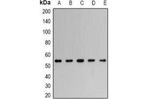 Western blot analysis of TRAF2 expression in HeLa (A), PC12 (B), Romas (C), Jurkat (D), NIH3T3 (E) whole cell lysates. (TRAF2 Antikörper)