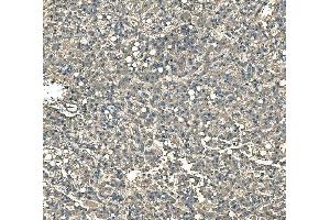 IHC analysis of Serum Amyloid P/APCS using anti-Serum Amyloid P/APCS antibody (ABIN5693182).