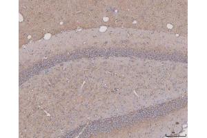 IHC analysis of Tau/MAPT using anti-Tau/MAPT antibody (ABIN7599268).