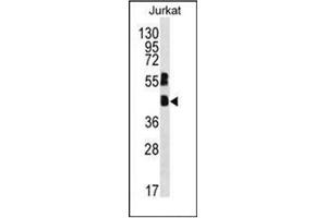 Western blot analysis of MAFB Antibody (C-term) in Jurkat cell line lysates (35ug/lane). (MAFB Antikörper  (C-Term))