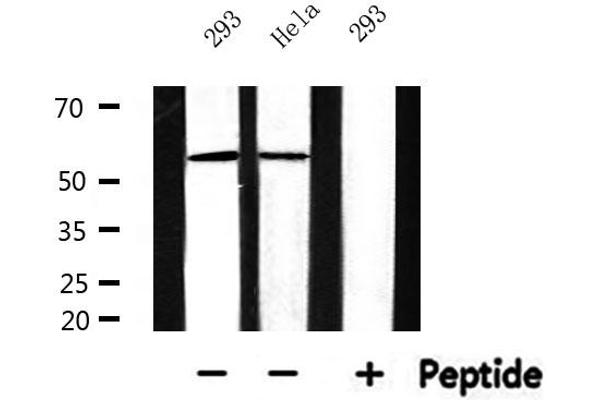 CYP17A1 Antikörper  (Internal Region)