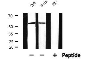 Western blot analysis of extracts from 293 and Hela, using Cytochrome P450 17A1 Antibody. (CYP17A1 Antikörper  (Internal Region))