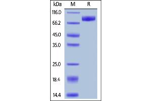 Human IL-1 Rrp2, Fc Tag on  under reducing (R) condition. (IL1RL2 Protein (AA 20-335) (Fc Tag))