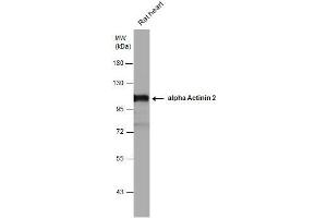 WB Image alpha Actinin 2 antibody detects alpha Actinin 2 protein by western blot analysis.