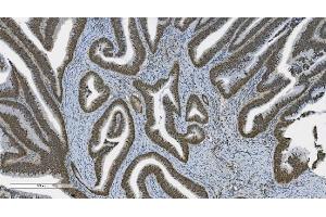 IHC analysis of PARP using anti-PARP antibody (ABIN7602278). (PARP1 Antikörper  (AA 670-858))