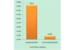 Immunohistochemistry analysis of paraffin-embedded human brain tissue using NMDAR1 (Phospho-Ser890) antibody. (GRIN1/NMDAR1 Antikörper  (pSer890))