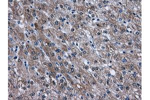 Immunohistochemical staining of paraffin-embedded liver tissue using anti-AKT2mouse monoclonal antibody. (AKT2 Antikörper)