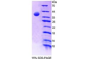 SDS-PAGE analysis of Human EPB41 Protein.