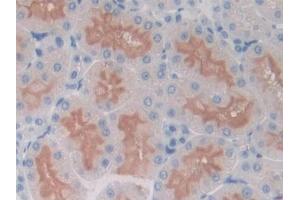 DAB staining on IHC-P; Samples: Rat Kidney Tissue (ICOS Antikörper  (AA 39-133))