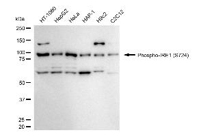 anti-Endoplasmic Reticulum To Nucleus Signaling 1 (ERN1) (pSer724) antibody