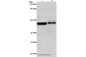 Western blot analysis of Hela and A549 cell, using ADRB2 Polyclonal Antibody at dilution of 1:600