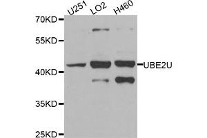 Western blot analysis of extracts of various cell lines, using UBE2U antibody (ABIN5974574) at 1/1000 dilution. (UBE2U Antikörper)