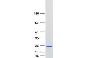 Western Blotting (WB) image for Interferon, alpha 1 (IFNA1) protein (Myc-DYKDDDDK Tag) (ABIN2712302)