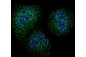 Immunofluorescent analysis of Hela cells, using Cyclin B1 Antibody . (Rekombinanter Cyclin B1 Antikörper)