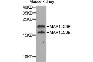 Western blot analysis of extracts of mouse kidney, using MAP1LC3B antibody (ABIN5973262) at 1/1000 dilution. (LC3B Antikörper)