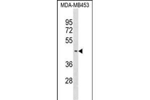 SUV39H2 Antibody (C-term) (ABIN1537206 and ABIN2838148) western blot analysis in MDA-M cell line lysates (35 μg/lane).