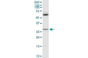 CTF1 MaxPab rabbit polyclonal antibody. (Cardiotrophin 1 Antikörper  (AA 1-201))