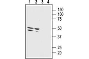 Western blot analysis of human malignant melanoma cell line Malme-3M (lanes 1 and 3) and human normal skin fibroblast cell line Malme-3 (lanes 2 and 4): - 1,2. (Bombesin Receptor 3 Antikörper  (2nd Extracellular Loop))