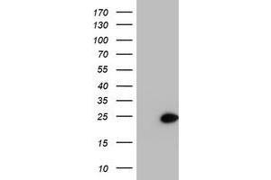HEK293T cells were transfected with the pCMV6-ENTRY control (Left lane) or pCMV6-ENTRY PSMB9 (Right lane) cDNA for 48 hrs and lysed. (PSMB9 Antikörper  (AA 21-219))