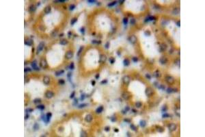 Used in DAB staining on fromalin fixed paraffin-embedded Liver tissue (C4A Antikörper  (AA 680-756))