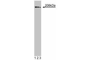 Western Blotting (WB) image for anti-Golgi Brefeldin A Resistant Guanine Nucleotide Exchange Factor 1 (GBF1) (AA 1266-1379) antibody (ABIN968745)