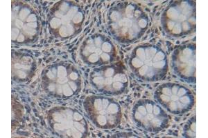 Detection of Cys-C in Human Intestine Tissue using Polyclonal Antibody to Cystatin C (Cys-C) (Cystathionine-gamma-Synthase Precursor (CYS) (AA 27-146) Antikörper)