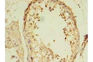 Immunohistochemistry (IHC) image for anti-MORC Family CW-Type Zinc Finger 2 (MORC2) (AA 2-300) antibody (ABIN7160198)