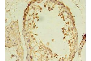 Immunohistochemistry of paraffin-embedded human testis tissue using ABIN7160198 at dilution of 1:100 (MORC2 Antikörper  (AA 2-300))