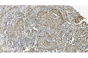 IHC analysis of MCM5 using anti-MCM5 antibody (ABIN7600583). (MCM5 Antikörper  (AA 206-723))